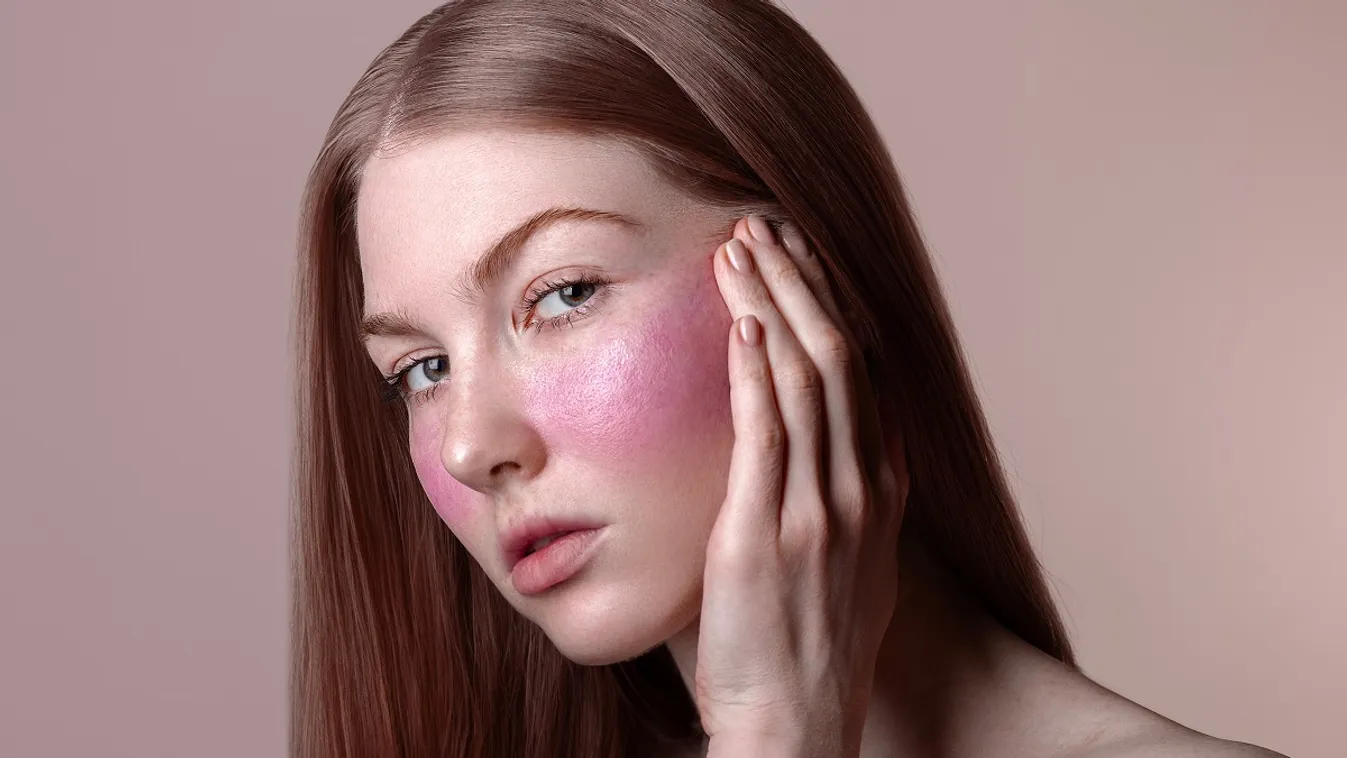 Rosacea: itt a megoldás az állandó kipirosodásra