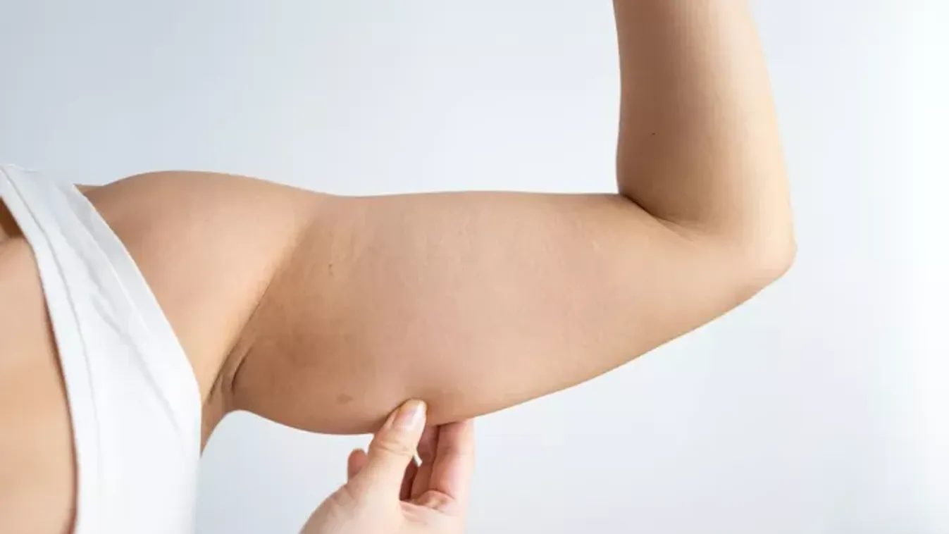 Viszlát, integető izom! Egyszerű tricepsz gyakorlatok otthonra