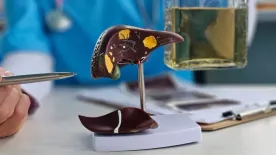 Áttörés a zsírmáj elleni küzdelemben: ez a vitamin lehet a megoldás!