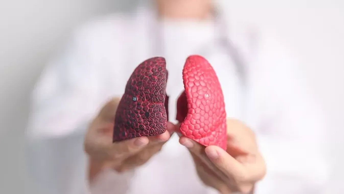 Nemcsak a cigaretta okozhat tüdőrákot – ezek az ételek is beteggé tehetnek!