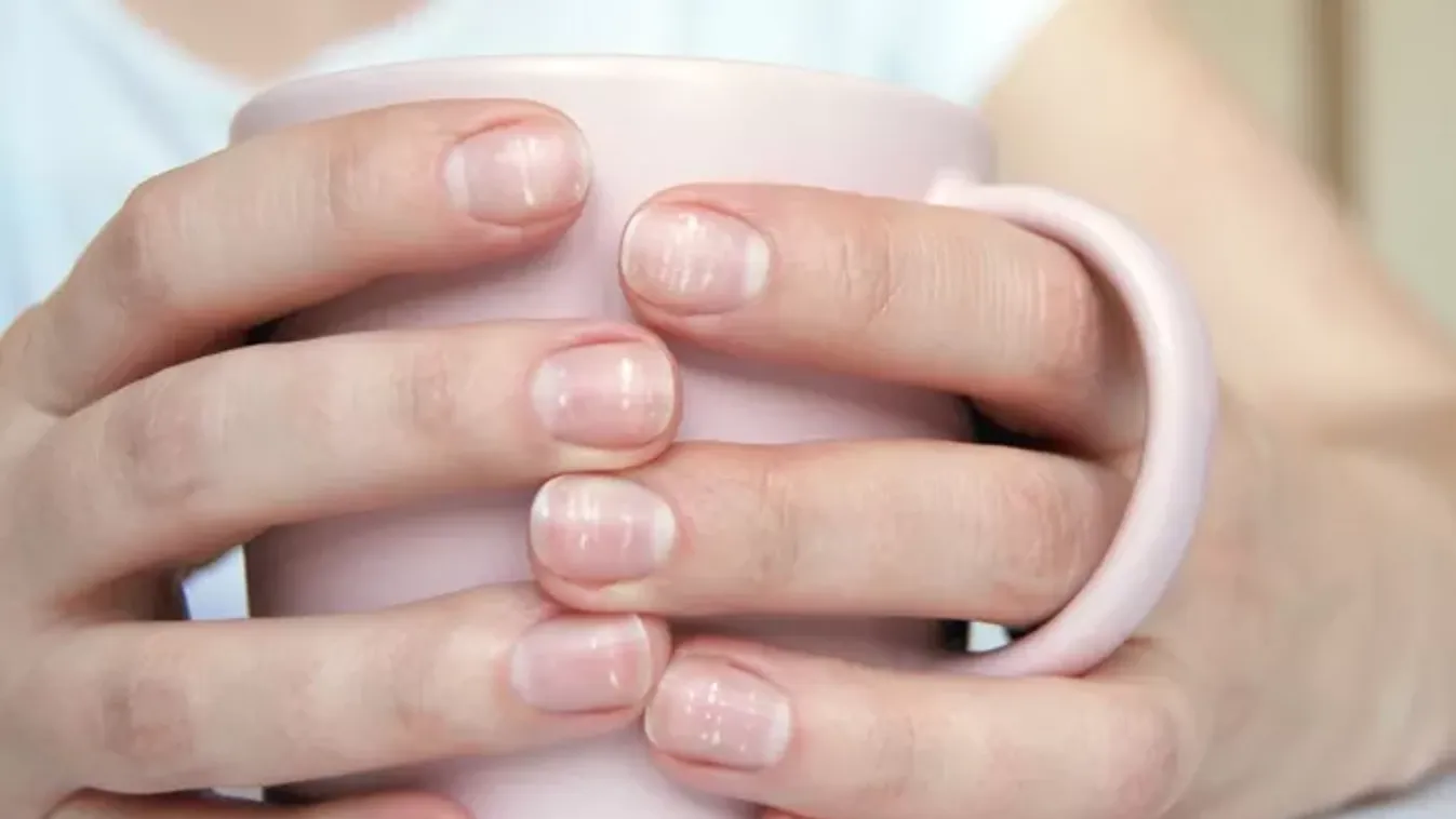 Fehér foltok a körmödön? Komoly vitaminhiány állhat a háttérben!
