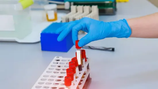 Aki ebbe a vércsoportba tartozik, lassabban öregszik