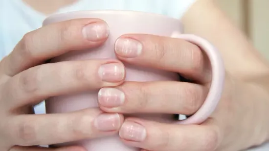 Fehér foltok a körmödön? Komoly vitaminhiány állhat a háttérben!