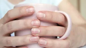 Fehér foltok a körmödön? Komoly vitaminhiány állhat a háttérben!