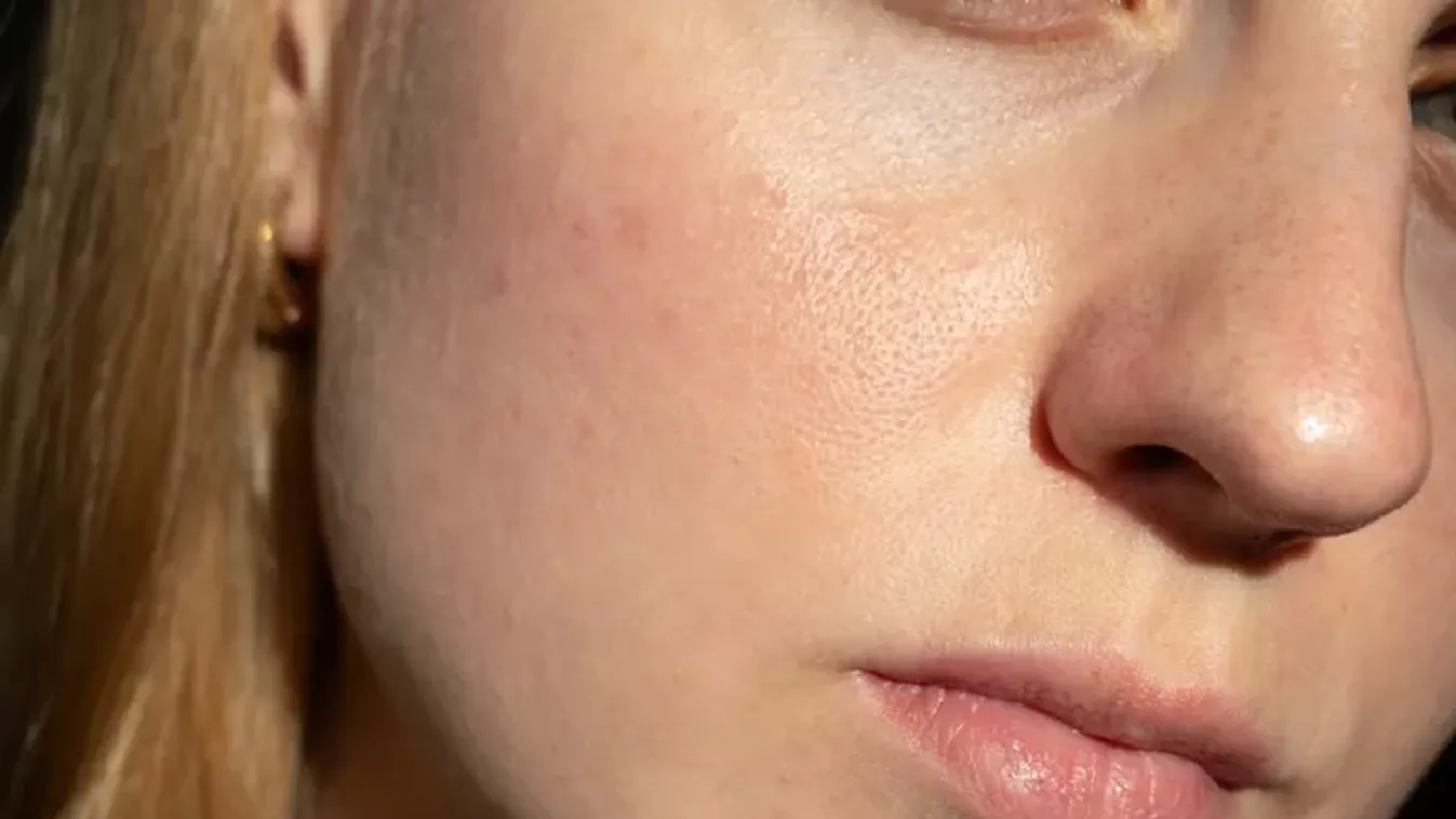 Mit üzen a bőröd? 6 jel, hogy vitaminhiányod van
