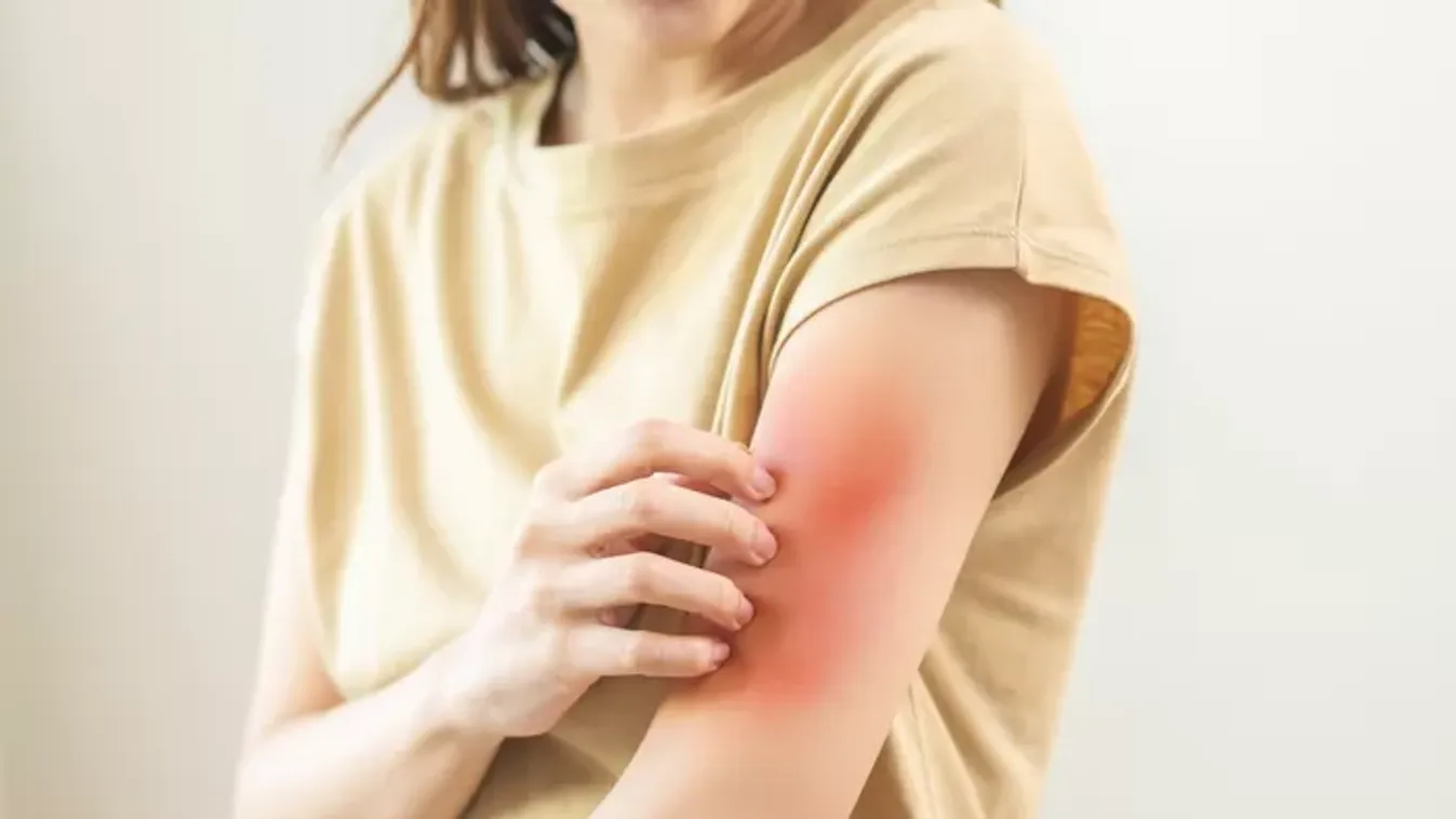 Valóban allergiásak lehetnek a nők a saját párjukra?
