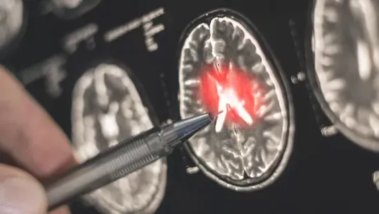 Új kutatás: ez az egyszerű szokás segíthet megelőzni a demenciát